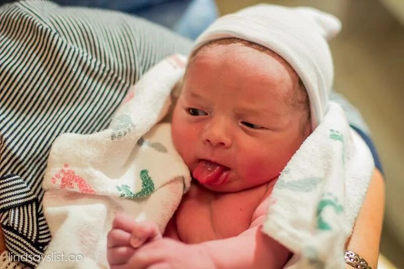 Новорожденные с синдромом дауна. Ребенок с высунутым языком. Грудной ребёнок высовывает язык. Грудничок высовывает язык. Почему ребенок постоянно высовывает язык.