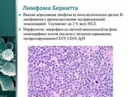 Агрессивная в клеточная лимфома
