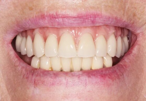 Politico эмблема. Бренд менеджер wildberries. Cio модель. Аппарат вектор паро. Startsmile лого.