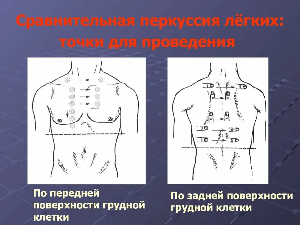 Голосовое дрожание в норме. Перкуссия грудной клетки пропедевтика. Топографическая перкуссия легких точки.