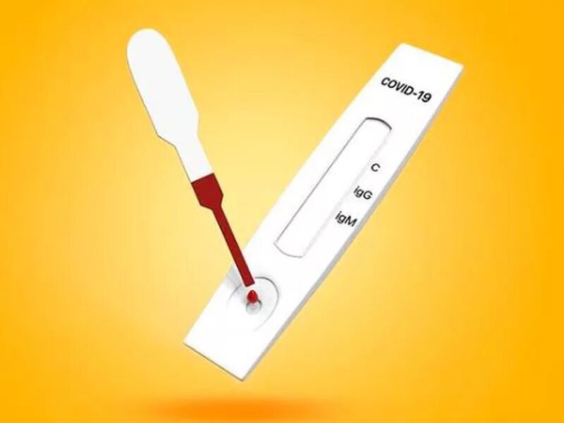 Экспресс тест на ковид как выглядит. Экспресс тест на коронавирус. иха тестирование на коронавирус. тест кассета на коронавирус. иха тест положительный.