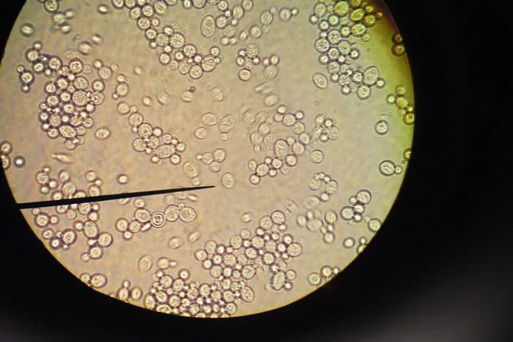 Дрожжей Saccharomyces cerevisiae микроскопия. Дрожжи Saccharomyces микроскопия. Saccharomyces cerevisiae под микроскопом х40. Saccharomyces Vini под микроскопом.