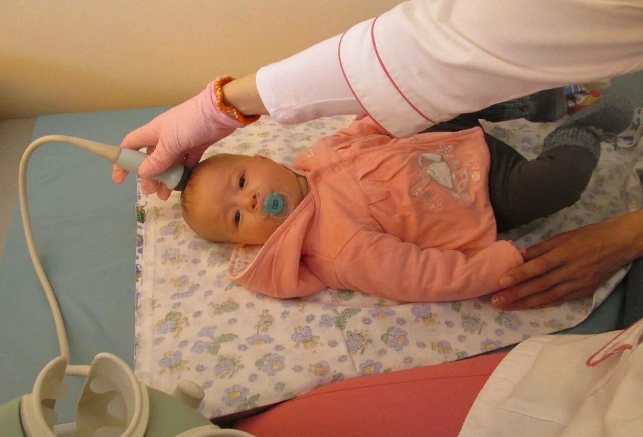 Нейросонография через родничок. Делают узи головы детям. Нсг нейросонография головного мозга. Узи головного мозга нейросонография. Нейросонография узи.