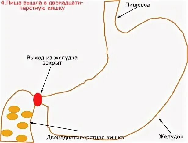 Желудок не закрывается