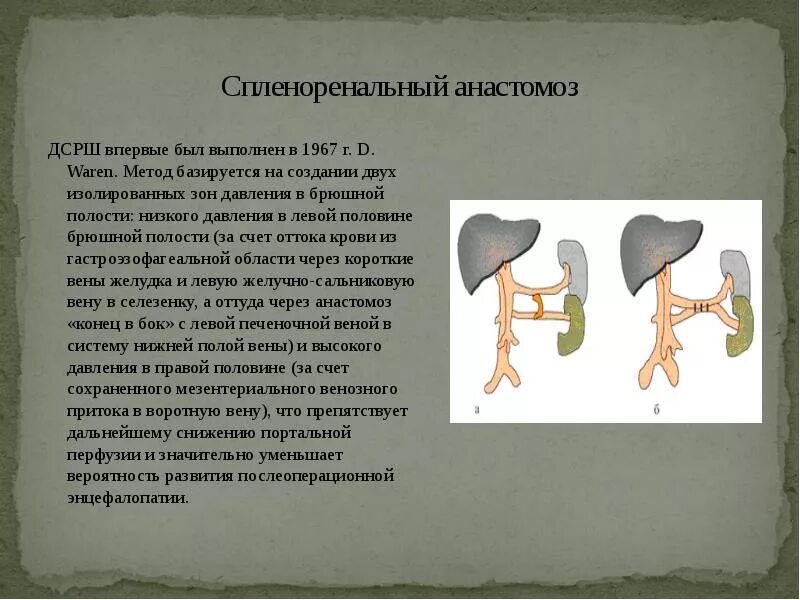 Операция при гипертонии. Спленоренальный анастомоз. спленоренальный анастомоз операция. спленоренальные анастомозы при портальной гипертензии. спленоренальный венозный анастомоз.