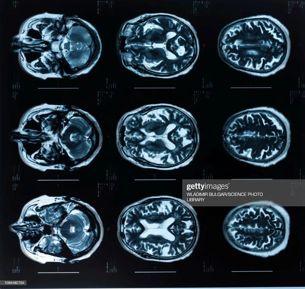 Можно ли мрт с ретейнерами. Мрт радиация. Мрт головы вектор. Magnetic Resonance Imaging.