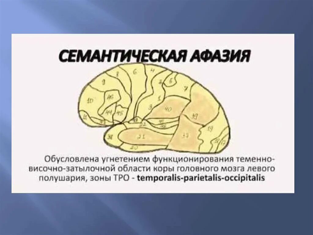Акустико семантической афазии. Семантическая афазия очаг поражения. семантическая афазия возникает при поражении. акустико семантическая афазия. очаг поражения при семантической афазии.