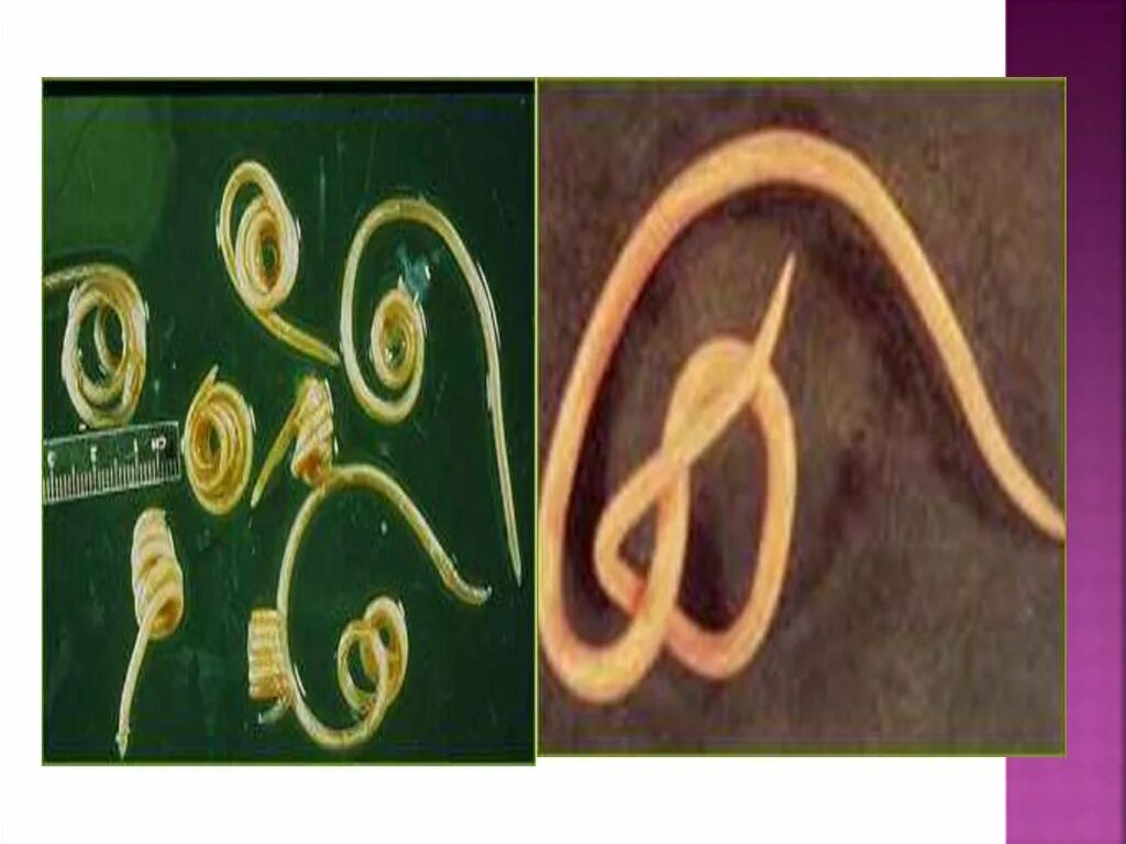 Гельминтозы передача. Классификация паразитов гельминтов. Энтеробиоз геогельминтоз. Пути заражения паразитическими червями. Пути передачи гельминтозов.