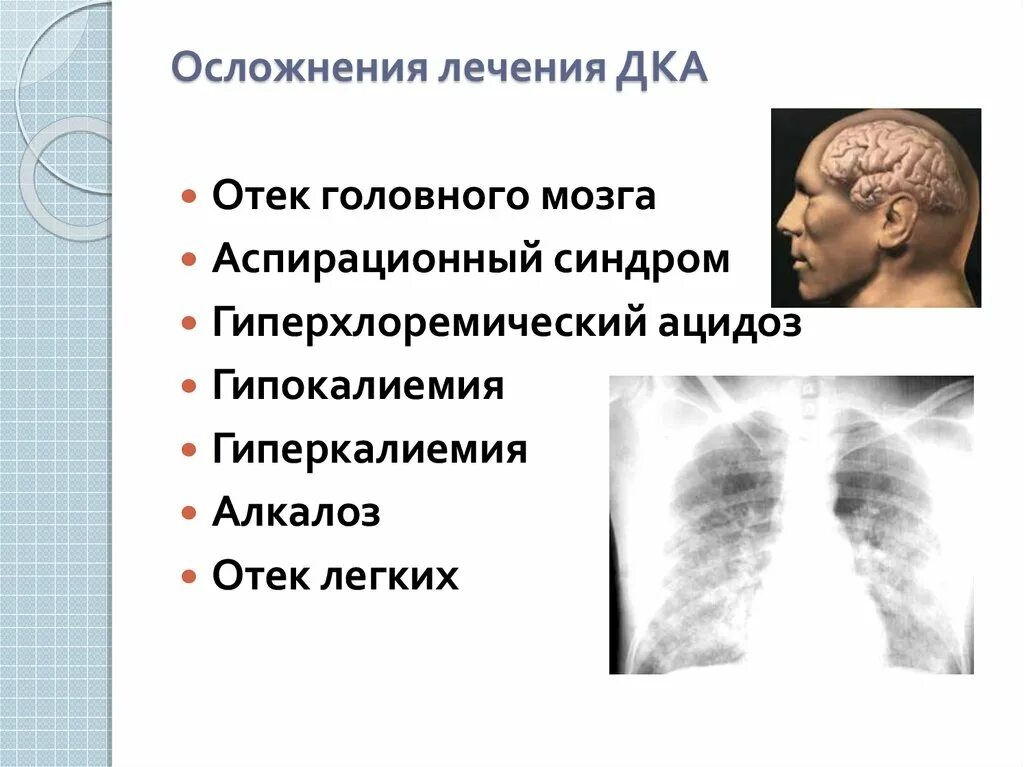 Признаком отека головного мозга являются. Отек головного мозга клиника. Отек головного мозга последствия. Отек мозга осложнения