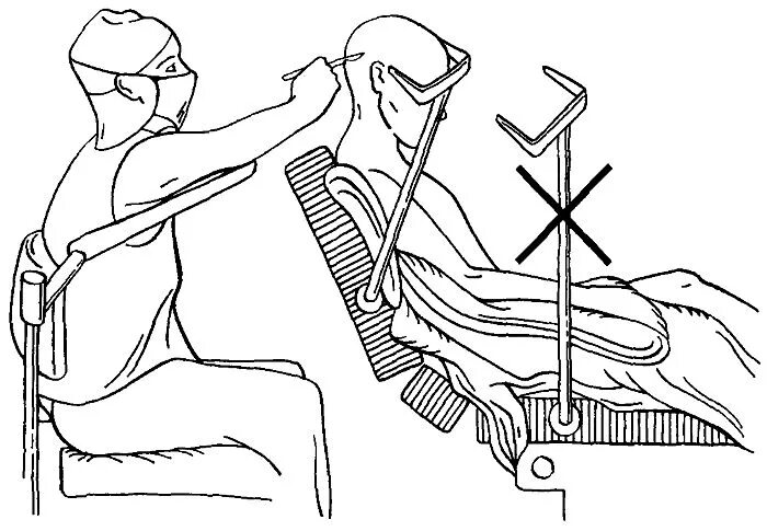 Положение больного на столе. Положение на операционном столе при нейрохирургических операциях. Положение сидя на операционном столе. Укладка больного на операционном столе при различных операциях. Положение сидя.