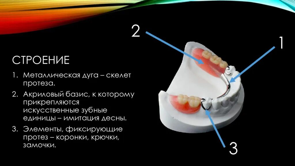 Бюгельные протезы лабораторные этапы