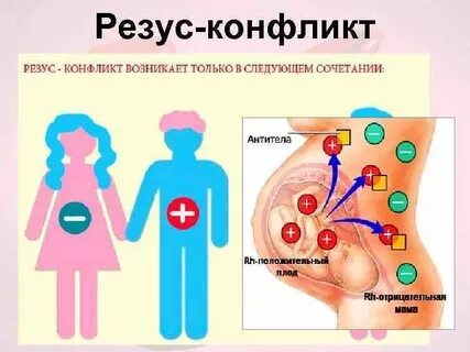 Конфликт антител