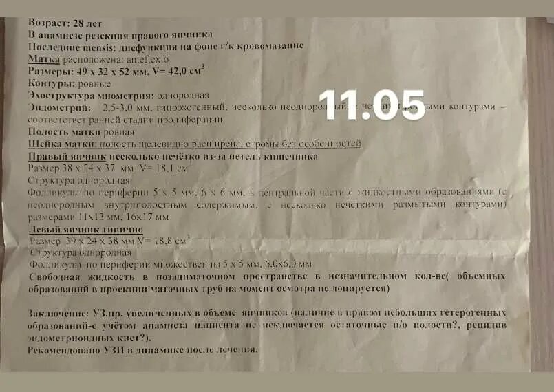 Пью дюфастон беременна. Схема отмены дюфастона при беременности. схема приема дюфастона. схема принятия дюфастона. схема применения дюфастона.