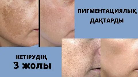 Уфадағы жыныстық қатынас