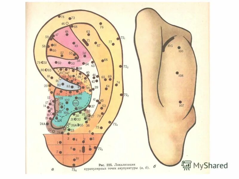 аурикулотерапия атлас точек. акупунктурные точки уха атлас. аурикулотерапия точки. акупунктурные точки ушной раковины. аурикулотерапия схема точек.
