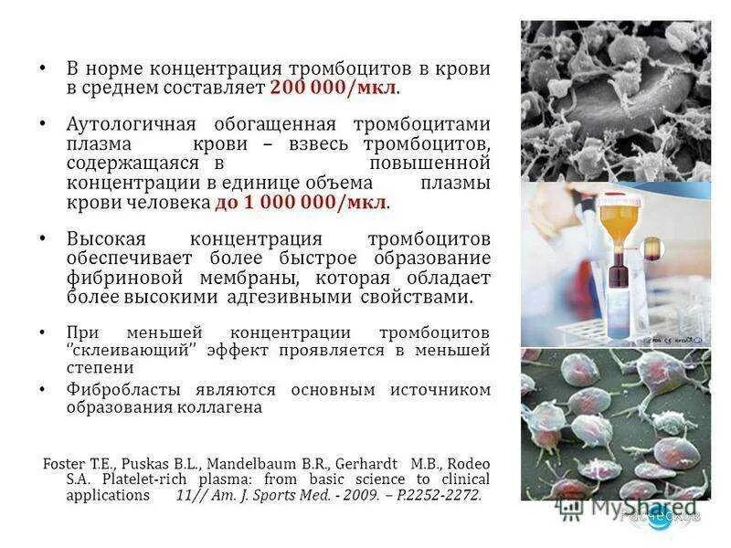 Содержание больших тромбоцитов повышено что значит
