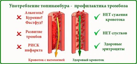 Отличие тромба от сгустка