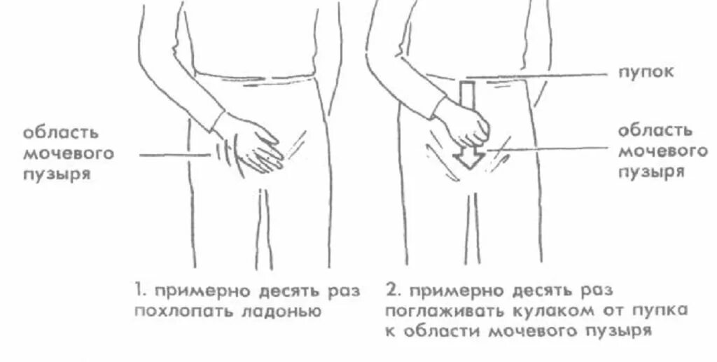 Тренировка мочевого пузыря. Упражнения для тренировки мышц мочевого пузыря. упражнения для опорожнения мочевого пузыря. упражнения для укрепления мышц мочевого пузыря при недержании. упражнения для мочевого пузыря для мужчин.