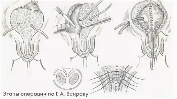 Кольпоскопическая картина эктопии шейки матки. Роды эктопия. Роды эктопия. Роды эктопия. Роды эктопия.