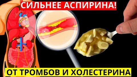 Тромб профилактика аспирин
