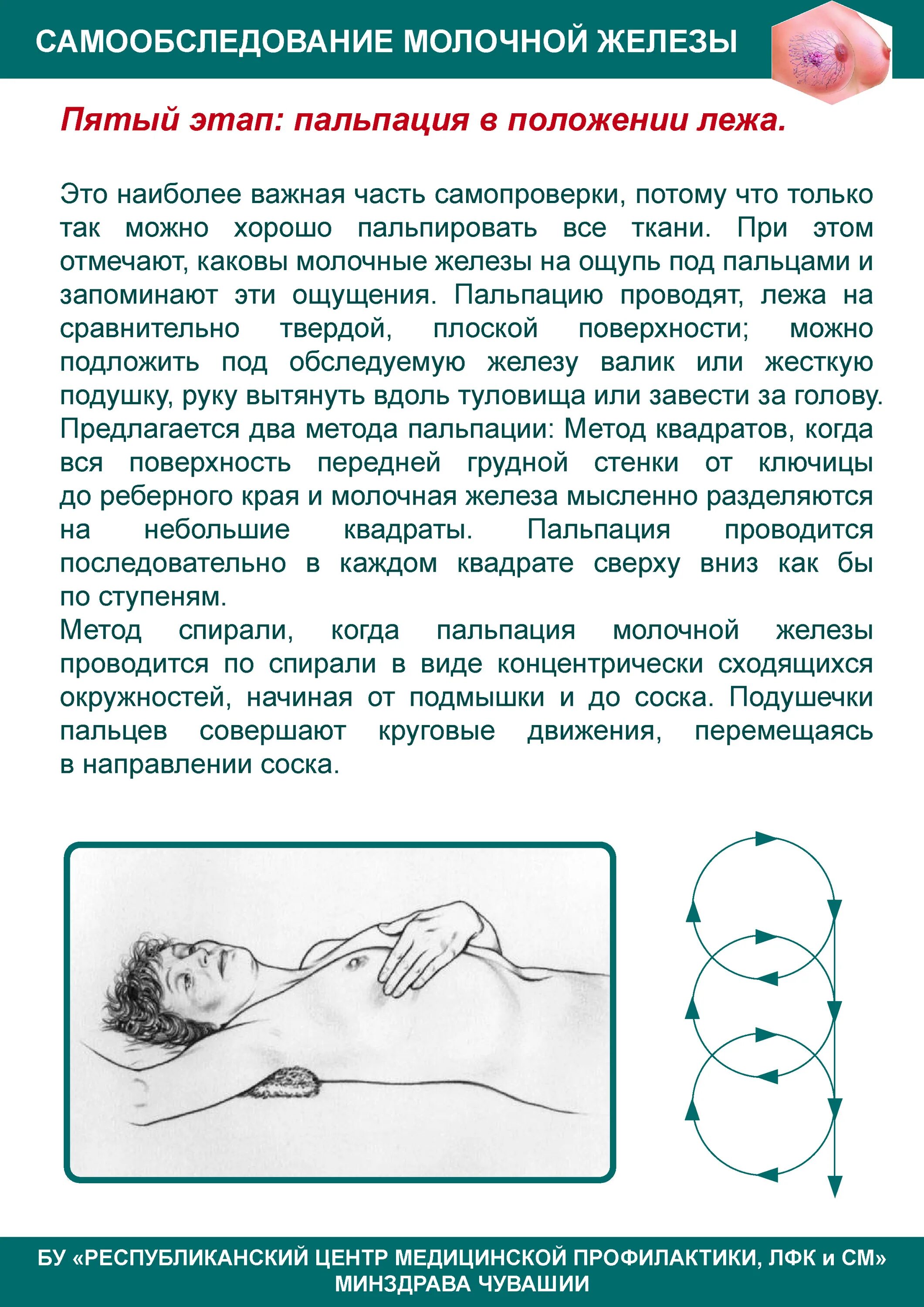 Как правильно обследовать молочные железы самостоятельно фото Киста молочной (грудной) железы лечение кисты в груди у женщин