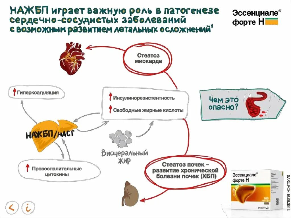 Печень больная жировой. Неалкогольная жировая болезнь печени. Неалкогольная жировая болезнь печени причины. Неалкогольная жировая болезнь печени факторы риска. Неалкогольная жировая болезнь печени патогенез.