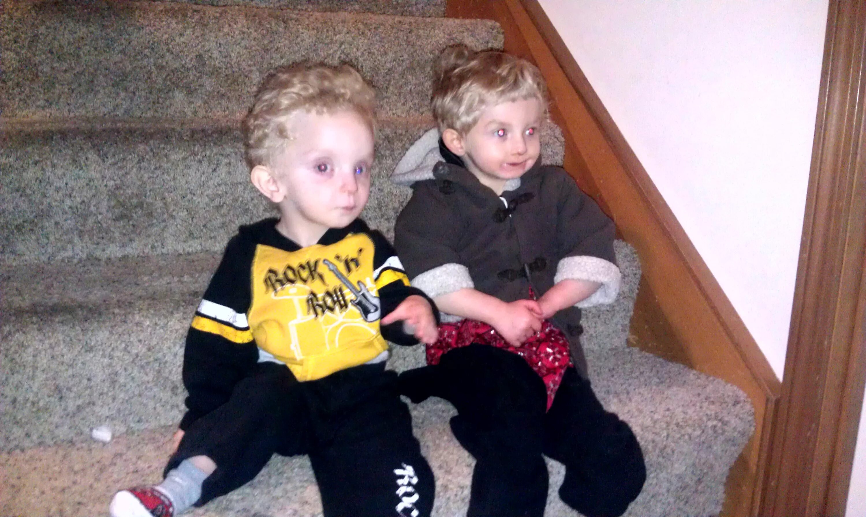 Как называют людей с отклонениями. Саймон и джордж каллены. Пип и флип дуэт сестер. Как называют людей с отклонениями. Лалит патидар мальчик оборотень.