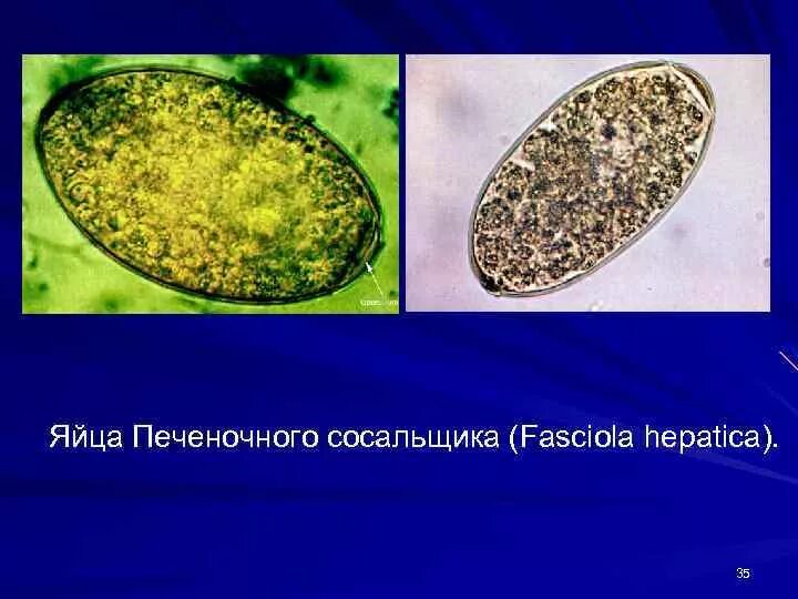 Fasciola hepatica яйца. Яйца гельминтов Fasciola hepatica. Яйца печеночного сосальщика микроскоп. Fasciola hepatica яйца строение. Печеночный сосальщик диагностика