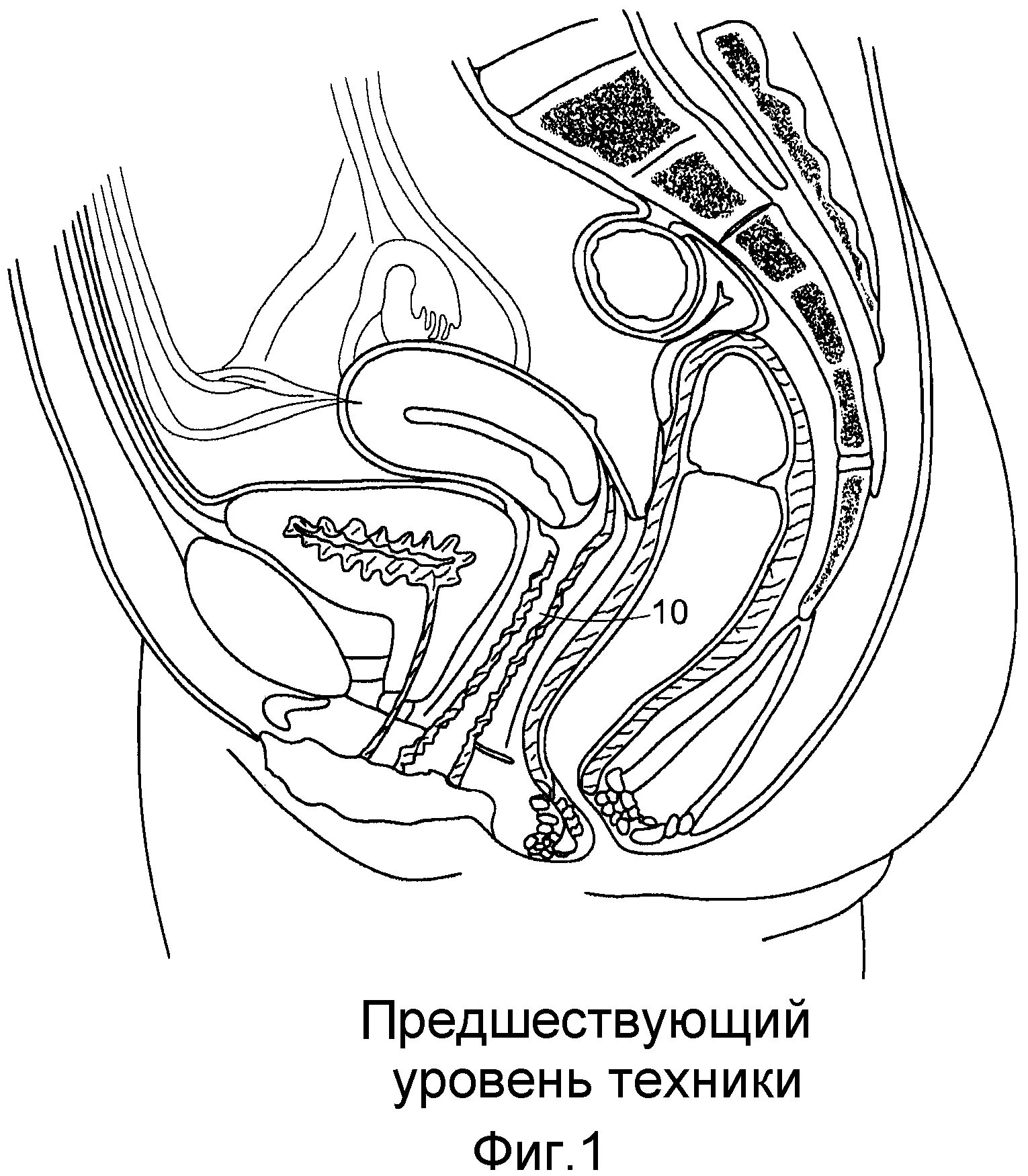Сквирт Во Время Акта