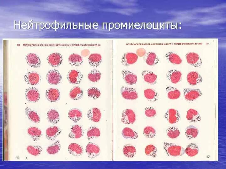 Метамиелоциты