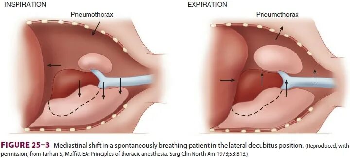 Мутация генов brca1 и brca2. Clin north am. Средство чистящее для различных поверхностей clin мультиблес. Терапия сд 2 типа клинические рекомендации. Clin north am.