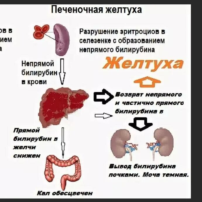 Вирусный гепатит билирубин