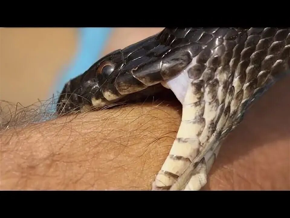 Как выглядит укус кобры दुनिया के 10 सबसे खतरनाक सांप// 10 Dangerous snake in the world episode/02 You