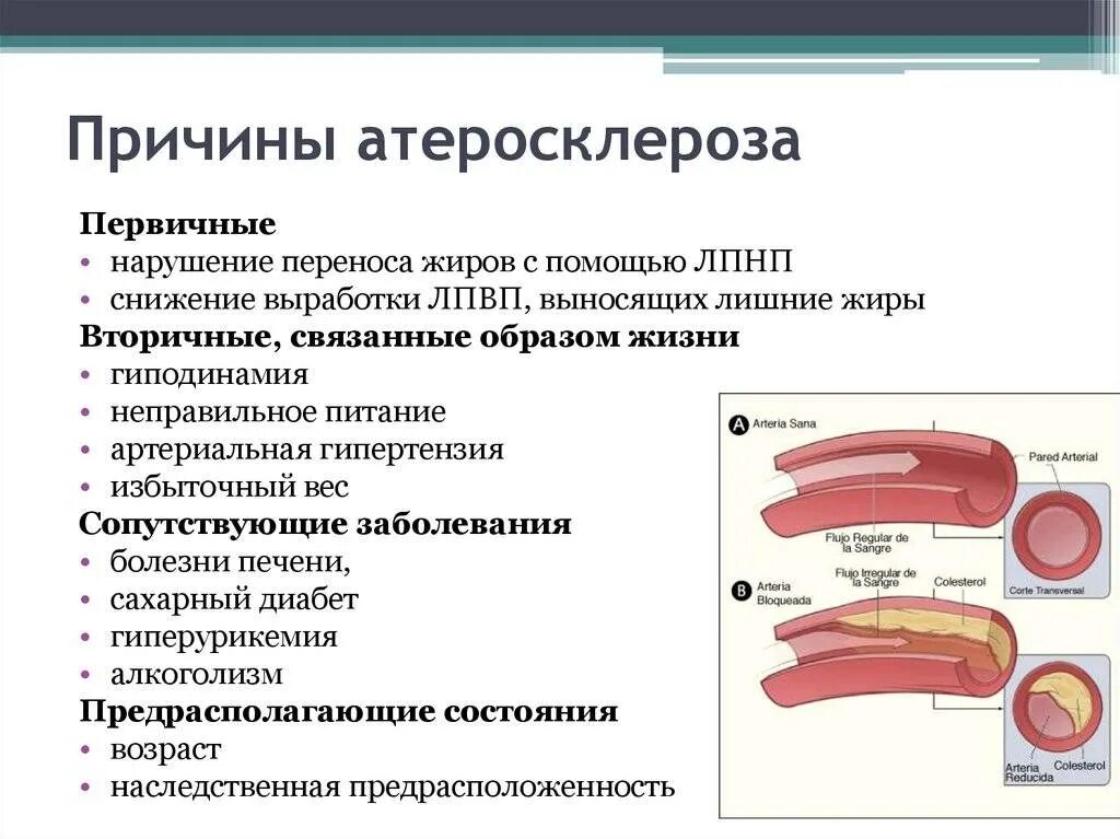 Признаки атеросклеротического поражения артерии. Причины развития атеросклероза сосудов. Факторы возникновения атеросклероза. Атеросклероз венечных сосудов сердца симптомы. Атеросклероз, основные причины и факторы риска..