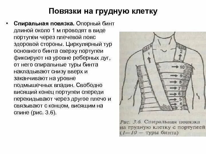 Повязка на грудную клетку алгоритм. Наложение повязки на грудную клетку алгоритм. Десмургия спиральная повязка. Спиральная повязка при переломе ребер. Бинтовая спиральная повязка на грудную клетку.