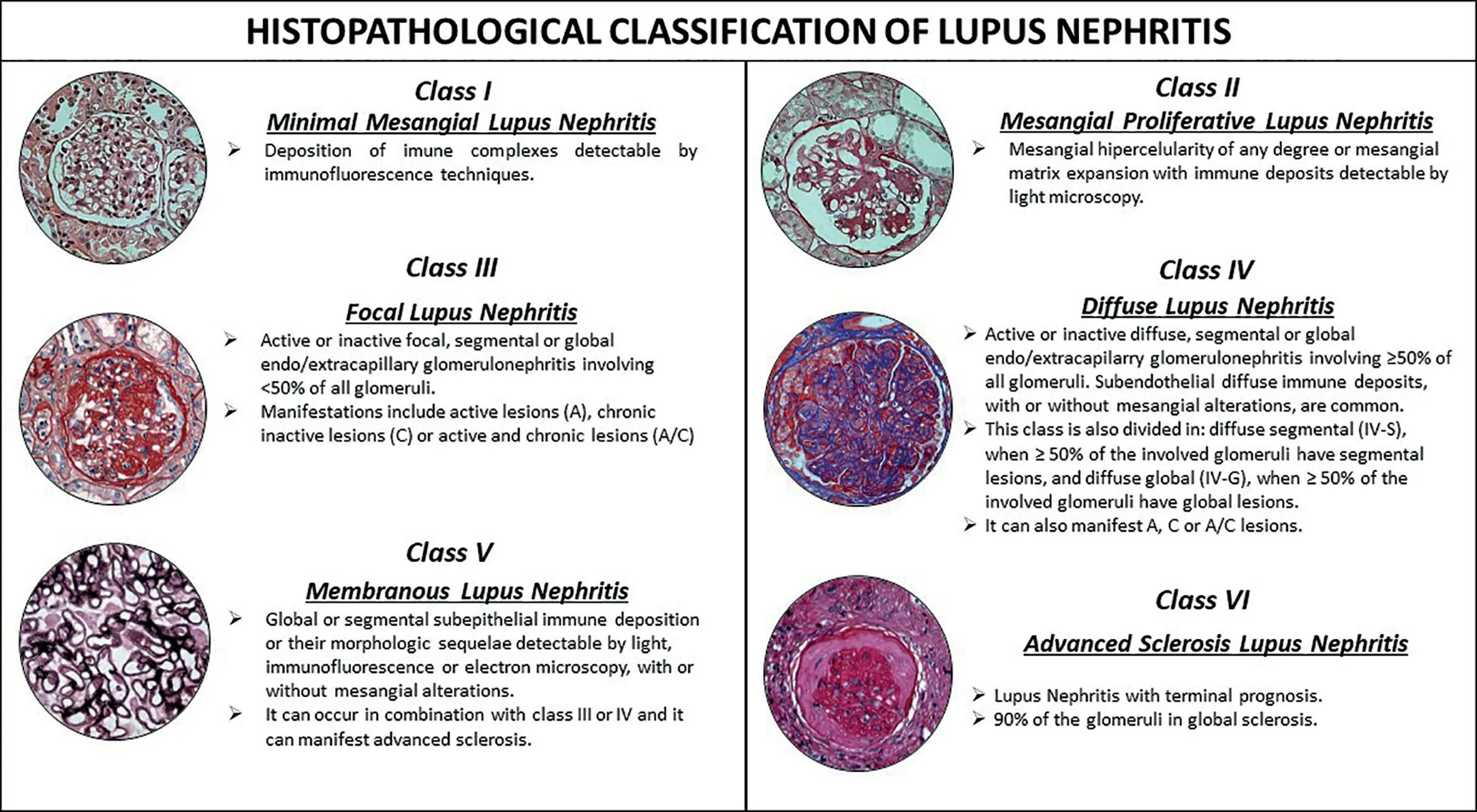 Nephritis значение термина. Lupus classification. lupus nephritis все.