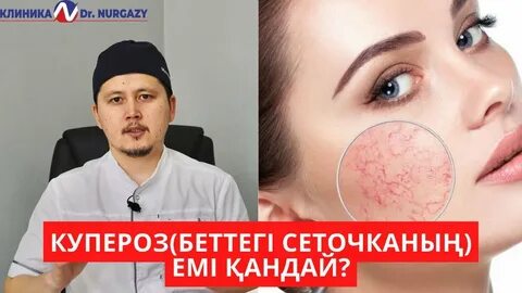 Света жезөкше фотоальбомы