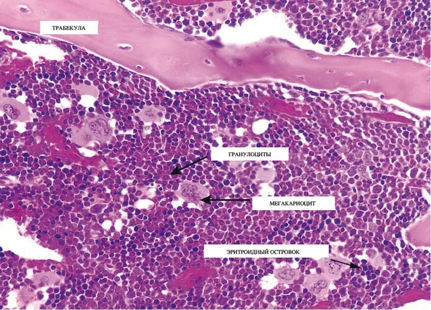 Гистология стромы что это. Bone marrow гистология. красный костный мозг микропрепарат. срез красного костного мозга гистология. гистологический препарат красный костный мозг.