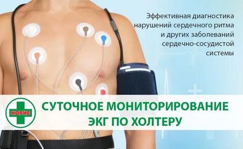Что показывает холтер сердца у взрослого