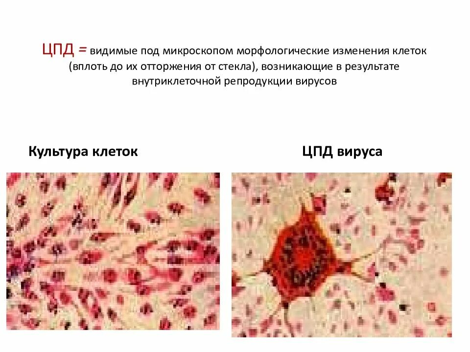 Морфологические изменения клеток. Культивирование вирусов в культуре клеток. Цитопатическое действие. Репродукция вирусов в культуре клеток.