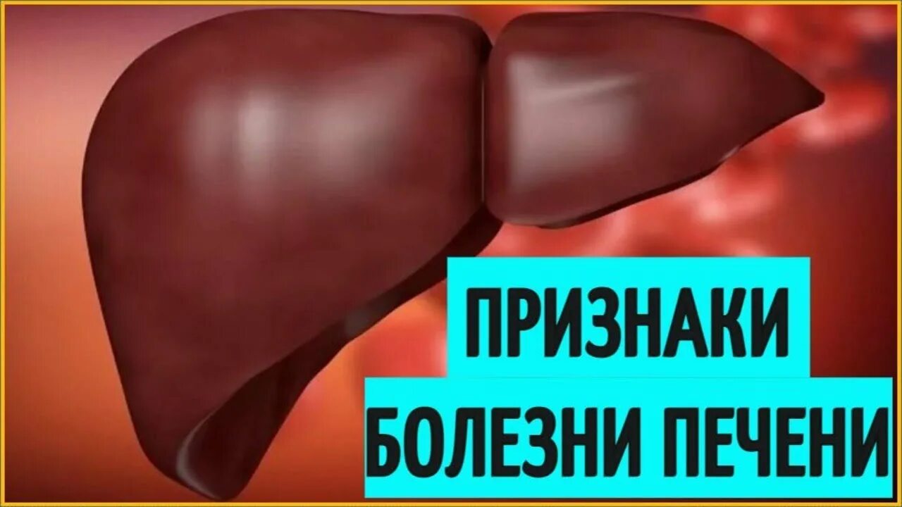 Лечении болезней печени у женщин. Симптомы болезни печени. Заболевание печени у женщин.