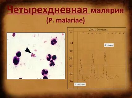 Трехдневная малярия