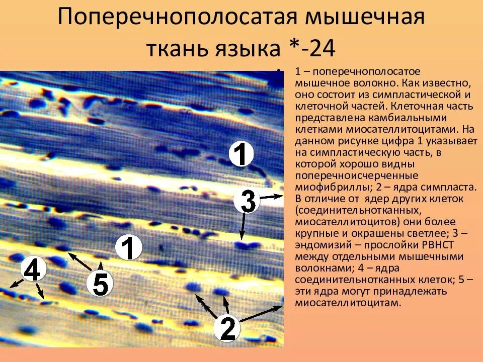 Поперечнополосатая сердечная мышечная ткань гистология. Поперечнополосатая сердечная мышечная ткань гистология препарат. Поперечнополосатая мышечная ткань Железный гематоксилин. Поперечно полосатые скелетные волокна. Препарат поперечно полосатая мышечная ткань