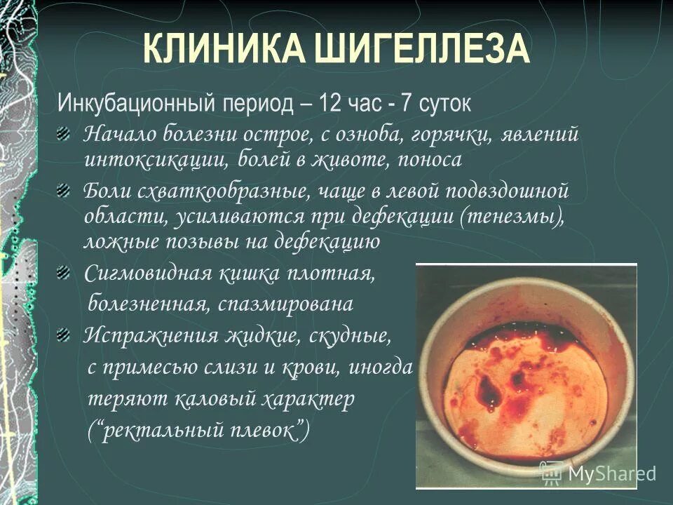 дизентерия клиника колитического варианта. шигеллез инкубационный период. колитический шигеллез. острая дизентерия гастроэнтероколитическая форма. шигеллез инкубационный период.