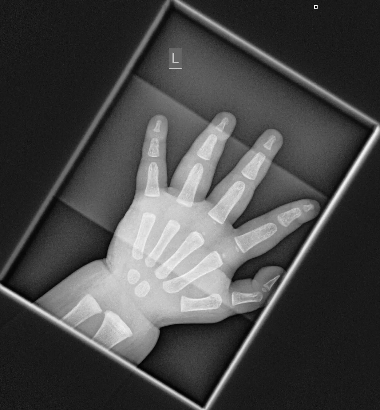 X ray мрт. Journal x ray. рентгеновская лампа. Xray рентген. Journal x ray.