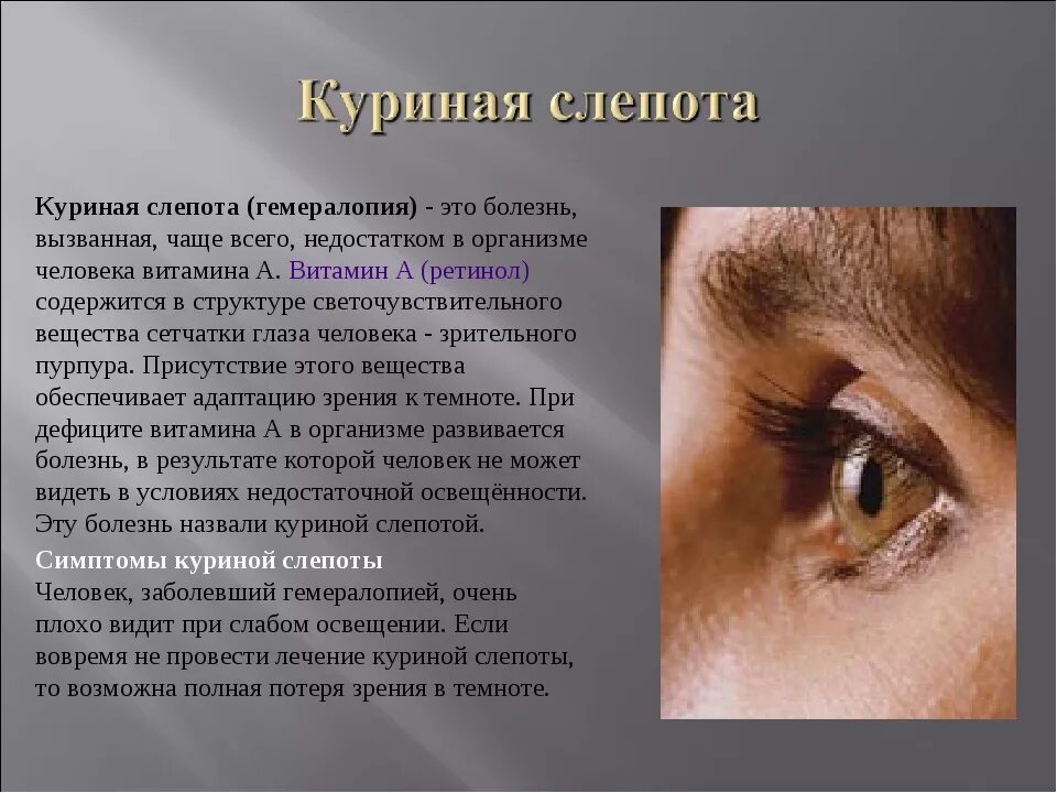Зрения глаза болезни. Куриная слепота болезнь. Куриная слепота заболевание глаз. Куриная слепота — расстройство сумеречного зрения..