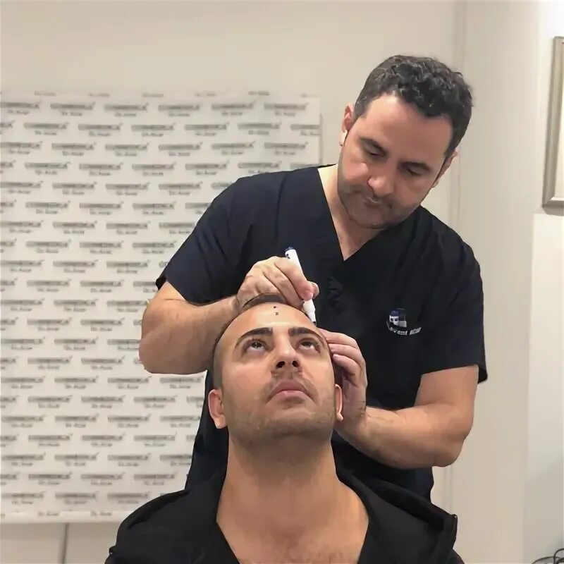 Трансплантация головы. Пересадка 5 часов. Пересадка 5 часов. Реабилитация после пересадки волос. Операция по пересадке волос.