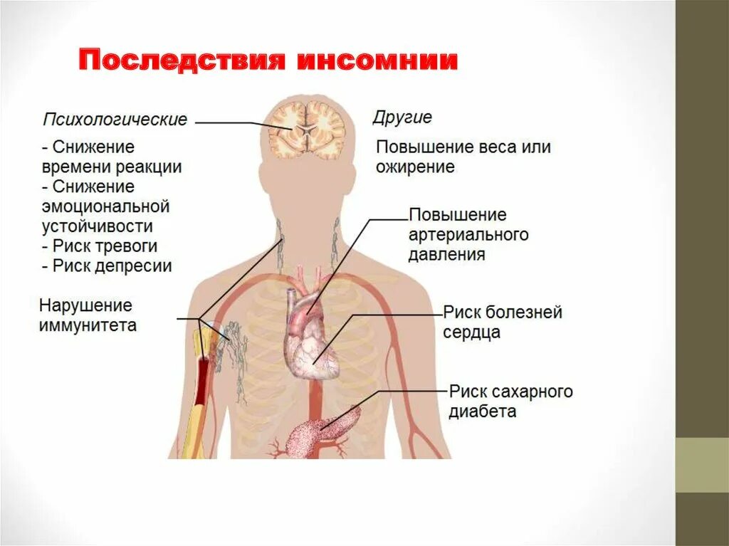 Грозит заболевание. Нарушение сна осложнения. Осложнение от бессонницы. Бессонница последствия для организма и психики. Инсомния симптомы.