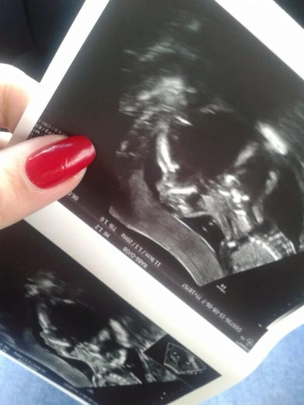 Pregnant 20 weeks. 20 неделя 2022. 20 неделя 2022. 20 неделя 2022. 20 неделя 2022.