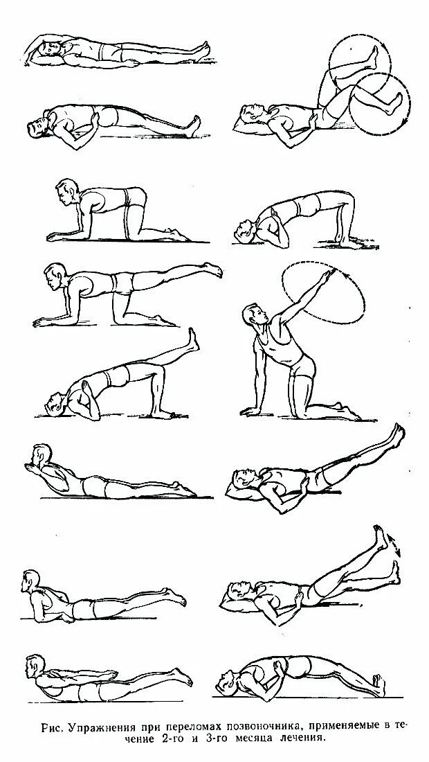 Гимнастика при компрессионном переломе позвоночника грудного. Гориневская древинг лфк комплекс упражнений. Лечебная физкультура при компрессионном. Метод гориневской древинг. Лфк при компрессионном переломе позвоночника у детей 1 период.